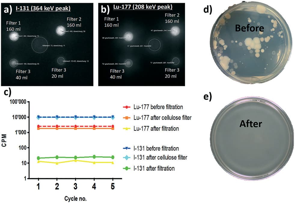Planar scintigraphy and PET-CT scan images showing radioactive isotopes captured on the amyloid membrane filter
