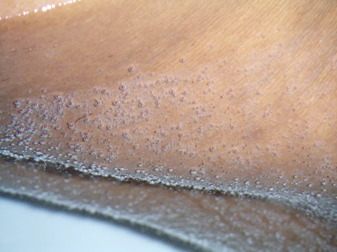 Macro photograph of fine air bubbles forming on skin under dynamized water